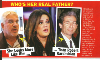 Illustration for article titled This Week in Tabloids: Here's a Picture of Taylor Swift's Breast Implant Scar